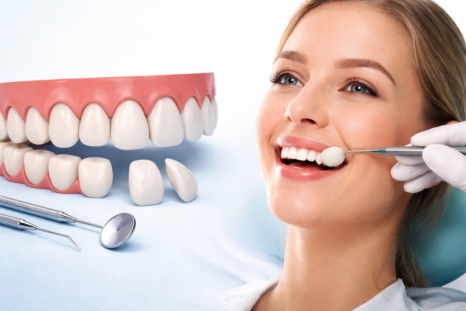 Veneers Before & After Transformation